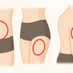 Abnehmspritzen – welche Einstichstelle ist die beste?